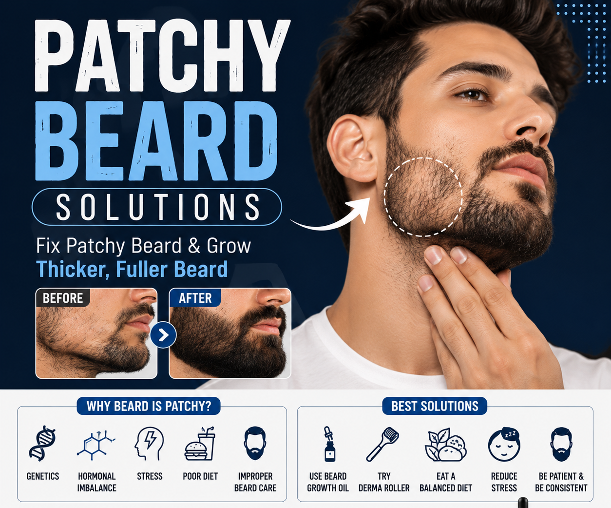 Patchy Beard Solutions